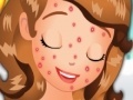 Igra Sofia Squeeze Pimples