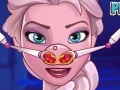 Igra Icy Girl Nose Problems