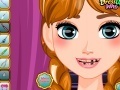 Igra Anna Frozen dentist